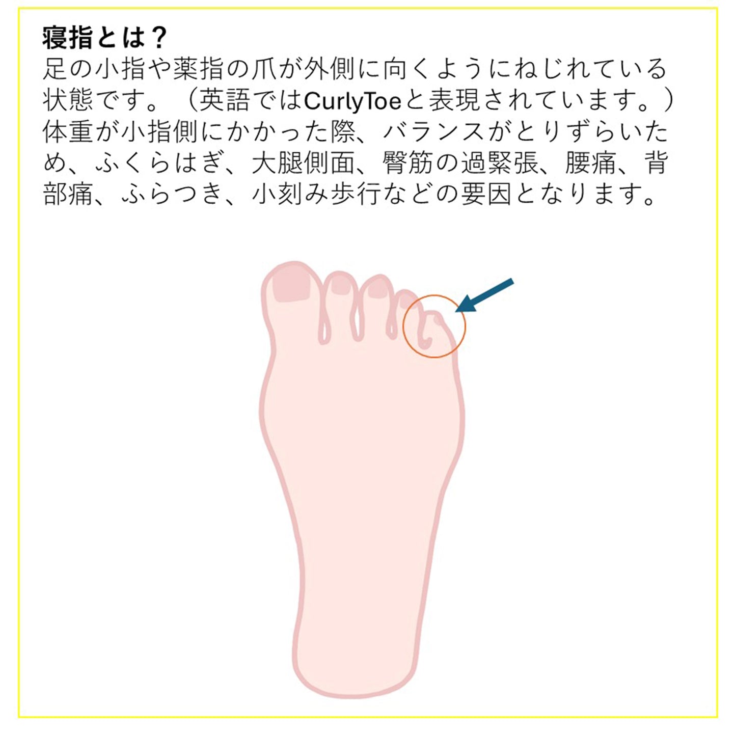 【XERO SHOES】ゼロシューズ パルキュアソロジー 寝指テープ 1.8cm×5m ※ネコポス可